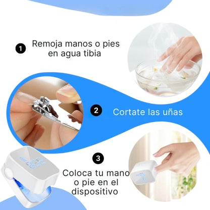 LumiNail Pro™ Elimina Hongos y Repara Uñas